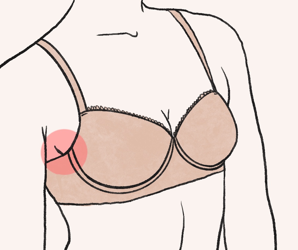 Bra underwire is sitting on your breast tissue