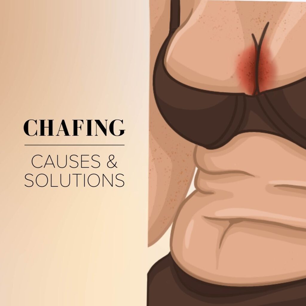 Chafing causes and solutions